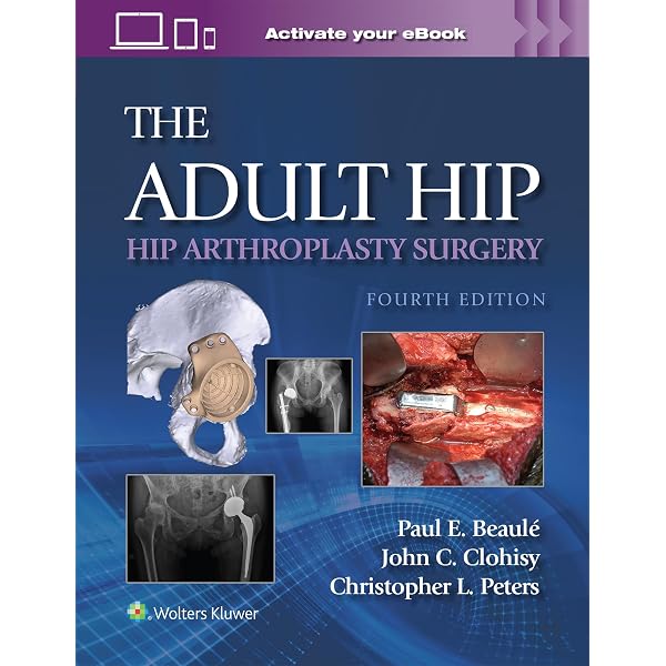 The Adult Hip: Hip Preservation Surgery: 9781451183931: Medicine